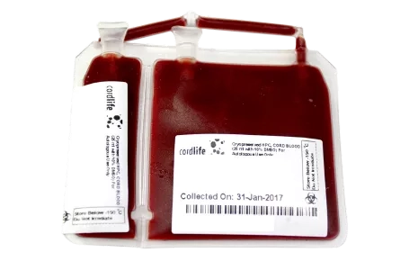 Cord Blood Collection, Processing and Storage | Cordlife Singapore