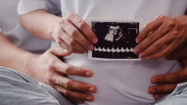 Pregnant lady and her husband holding up an ultrasound scan photo of their baby, 