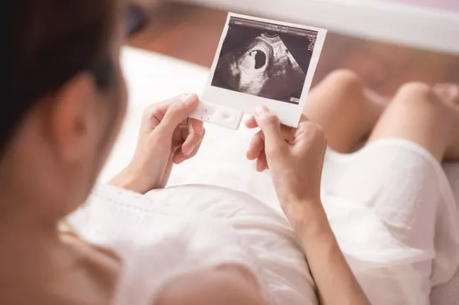 Pregnant mom holding an ultrasound scan in her hands.