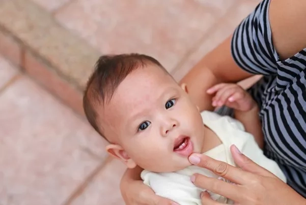 Baby resting his mother's arms and showing his deciduous teeth.